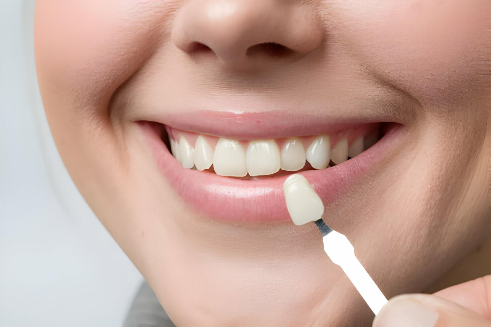 Cosmetic Dentistry Options: Enhancing Your Smile with Private Dental Treatments